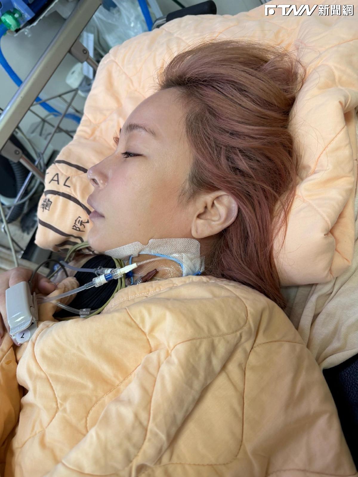 温嵐敗血症送加護病房10天！轉普通病房了　躺病床虛弱照曝光